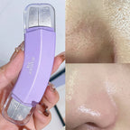 Stainless Steel Deep Cleansing Blackhead Remover & Pore Scrubber