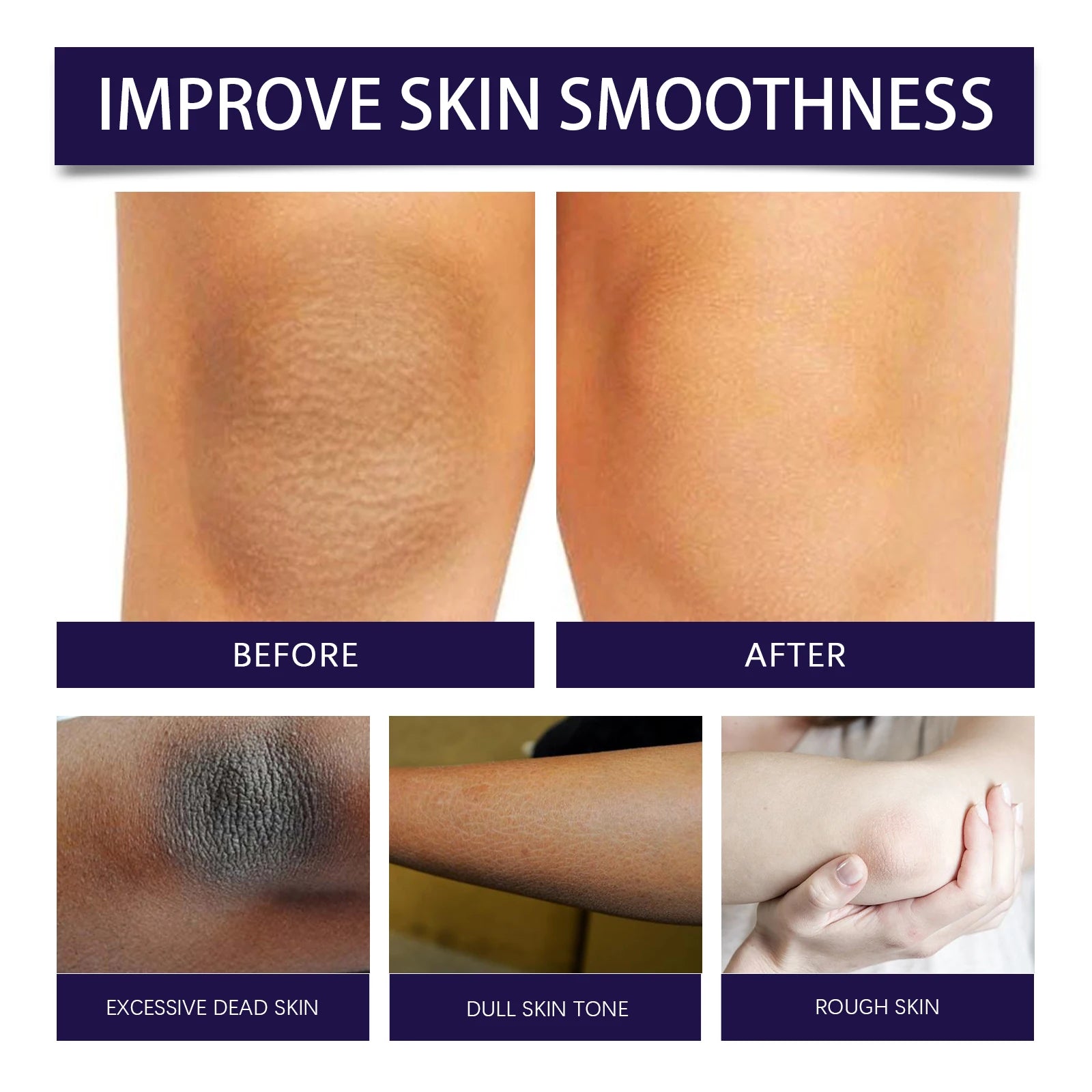 Eelhoe Body Scrub – 120g Deep Exfoliating & Brightening Treatment