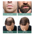 East Moon Intensive Hair Regrowth & Baldness Treatment Serum (30ml)