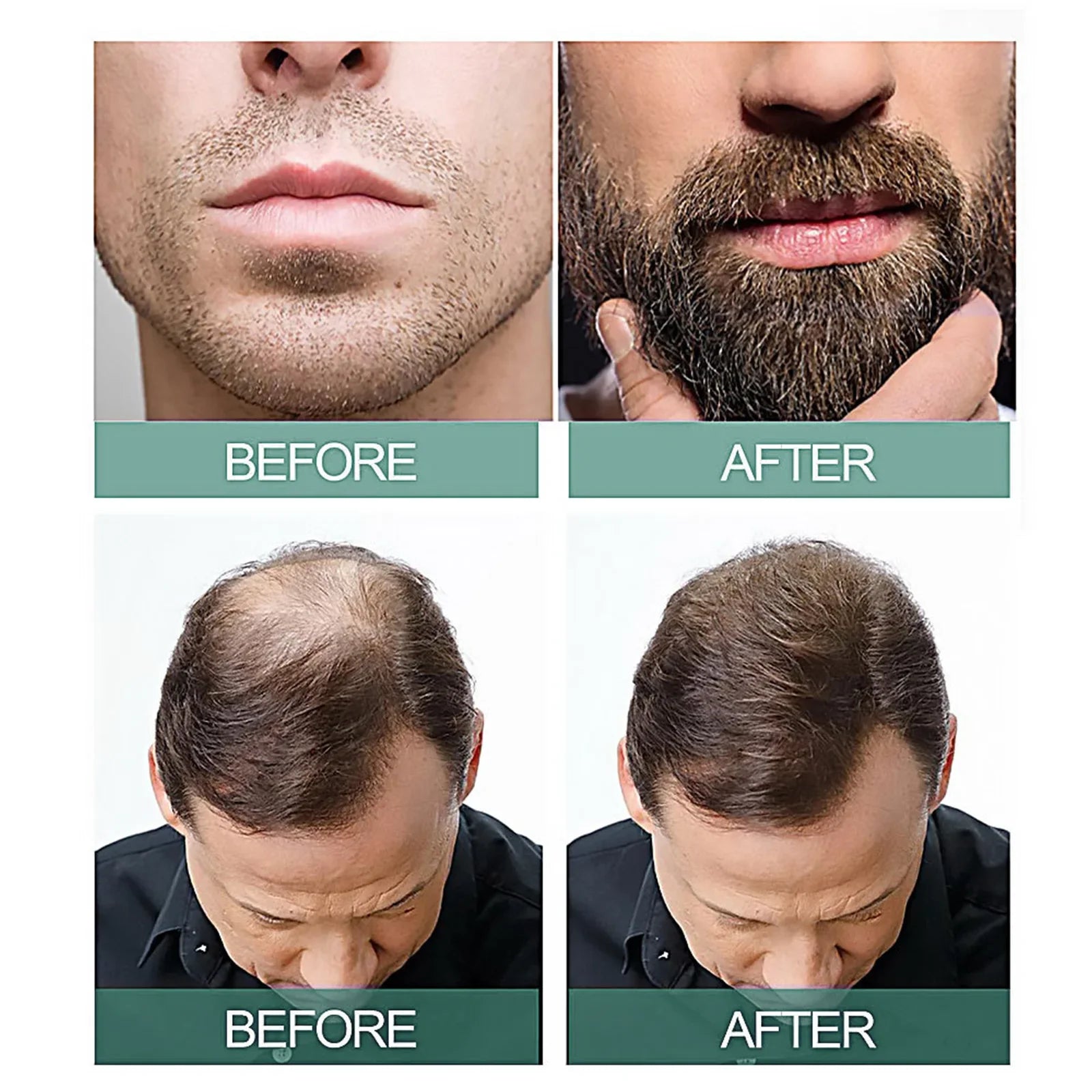 East Moon Intensive Hair Regrowth & Baldness Treatment Serum (30ml)