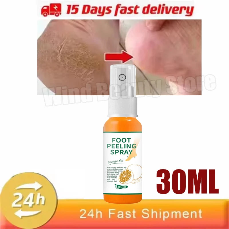 Eelhoe Herbal Anti-Crack Foot Repair Spray (100ml)